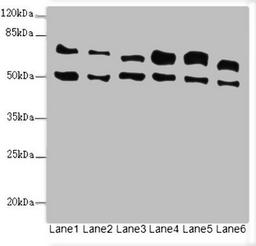 Western blot. All lanes: ELF2 antibody at 3.35ug/ml. Lane 1: HL60 whole cell lysate. Lane 2: A549 whole cell lysate. Lane 3: MCF-7 whole cell lysate. Lane 4: Jurkat whole cell lysate. Lane 5: Hela whole cell lysate. Lane 6: Mouse lung tissue. Secondary. Goat polyclonal to rabbit IgG at 1/10000 dilution. Predicted band size: 64, 63, 57, 58, 55 kDa. Observed band size: 64, 50 kDa. 