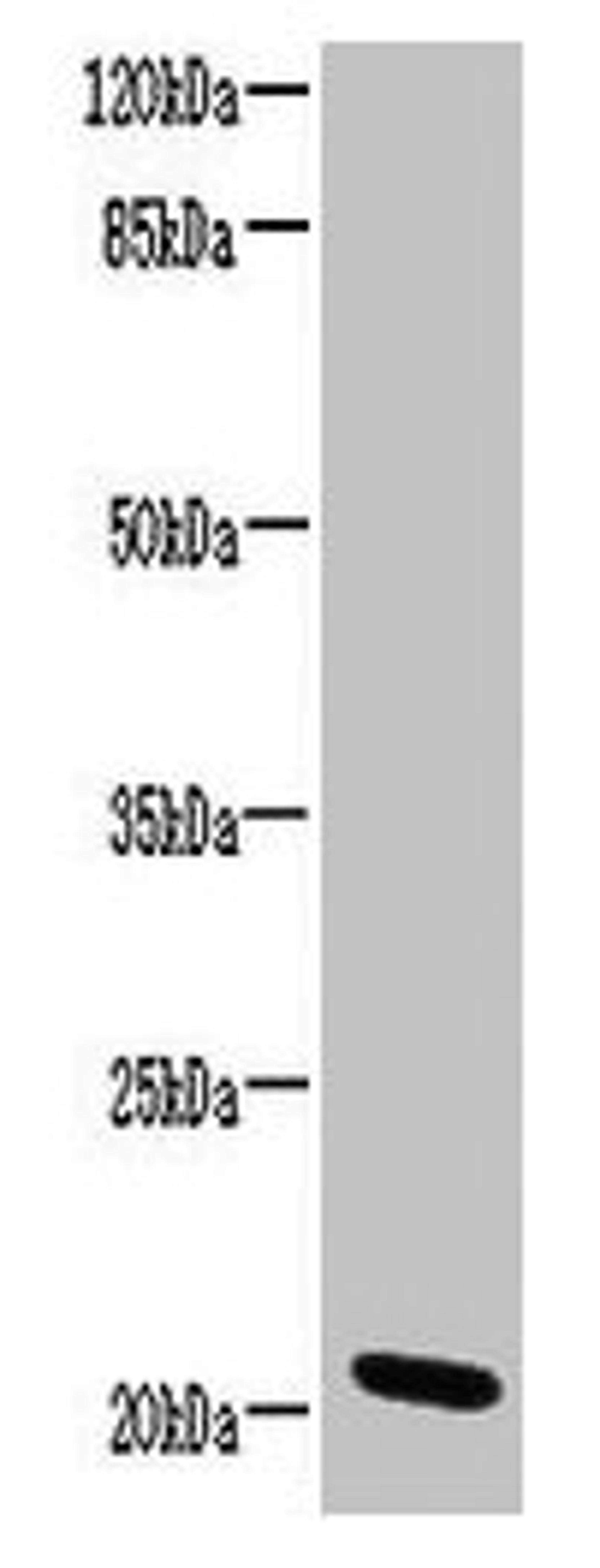 Western blot. All lanes: CCDC32 antibody at 2ug/ml + HL60 whole cell lysate. Secondary. Goat polyclonal to rabbit IgG at 1/10000 dilution. Predicted band size: 21, 22, 16 kDa. Observed band size: 21 kDa.