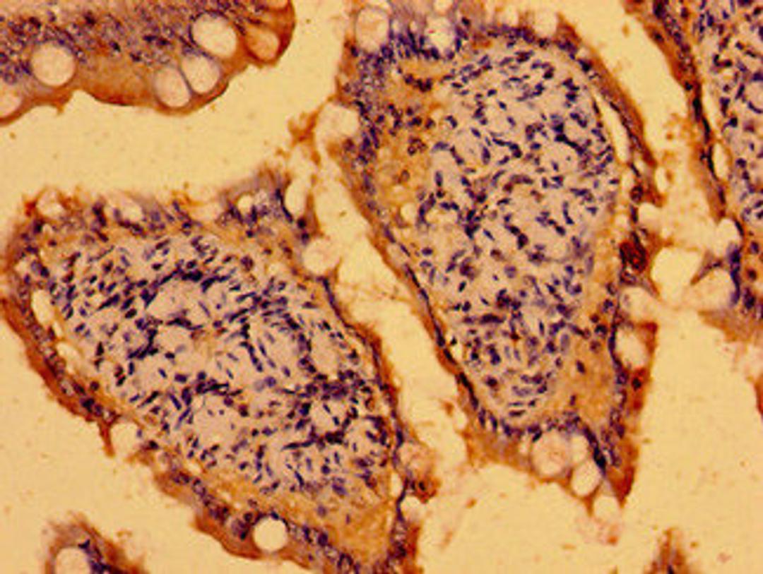Immunohistochemistry of paraffin-embedded human small intestine tissue using CSB-PA003434LA01HU at dilution of 1:100