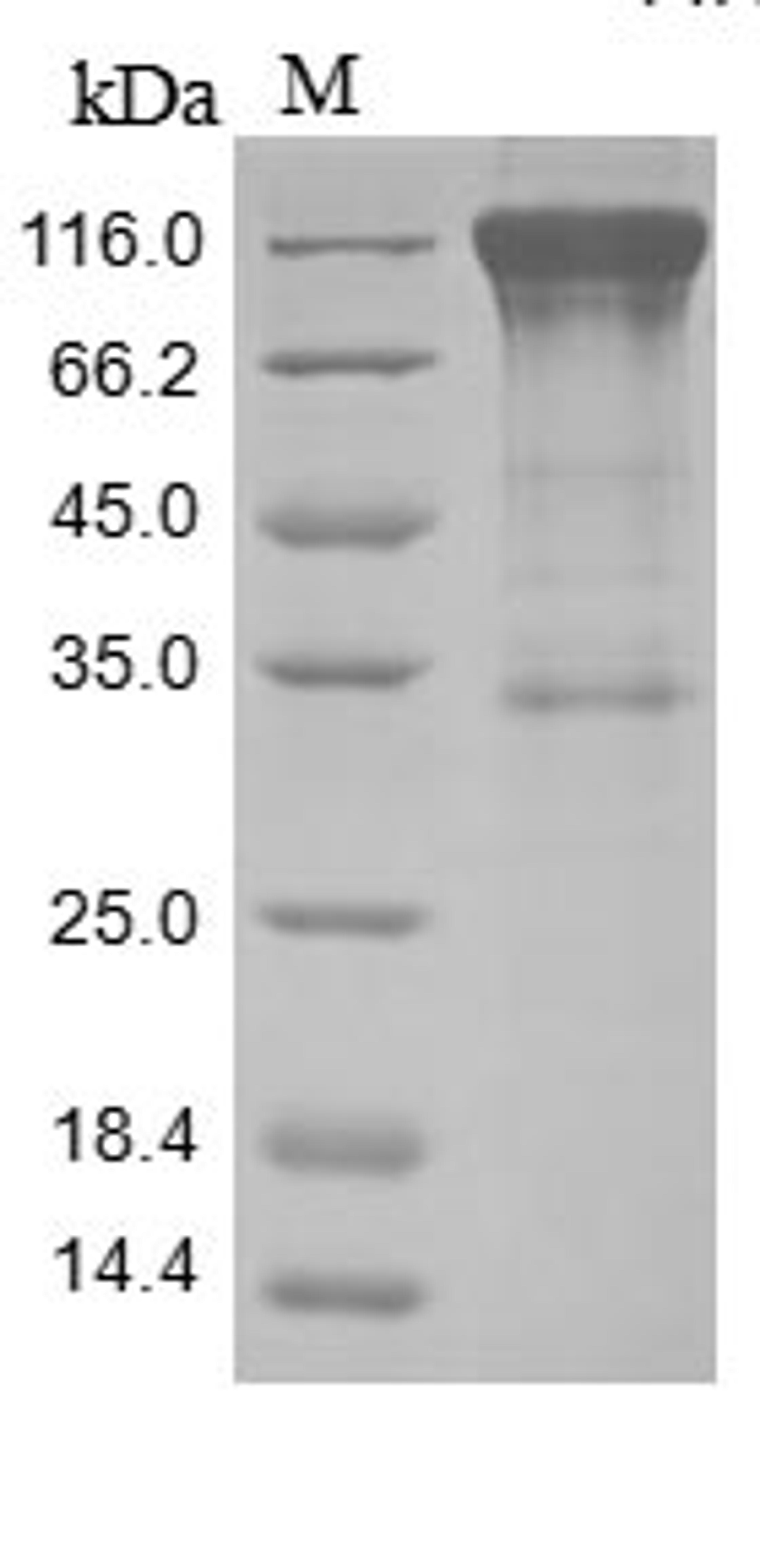 (Tris-Glycine gel) Discontinuous SDS-PAGE (reduced) with 5% enrichment gel and 15% separation gel.