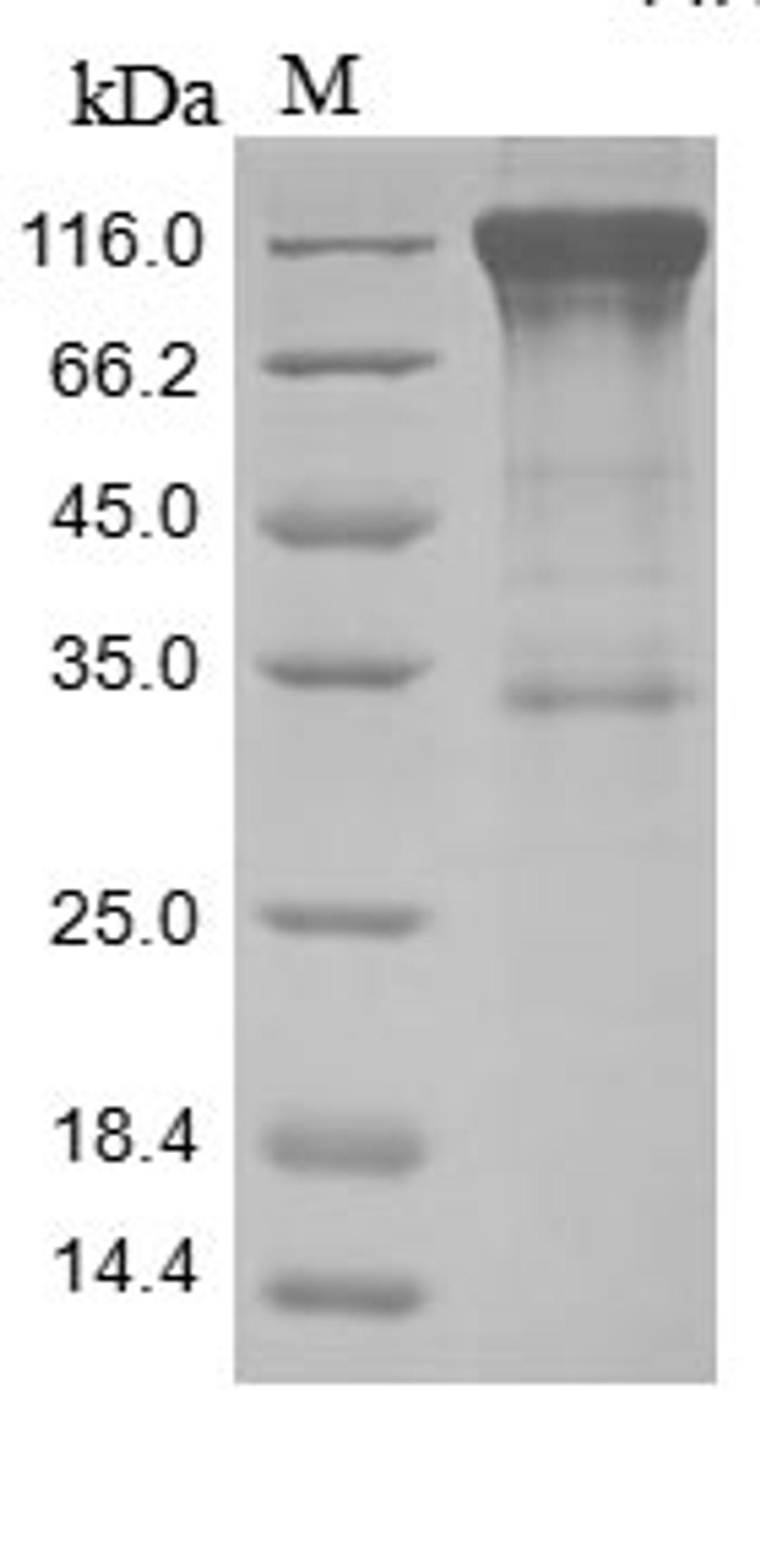 (Tris-Glycine gel) Discontinuous SDS-PAGE (reduced) with 5% enrichment gel and 15% separation gel.
