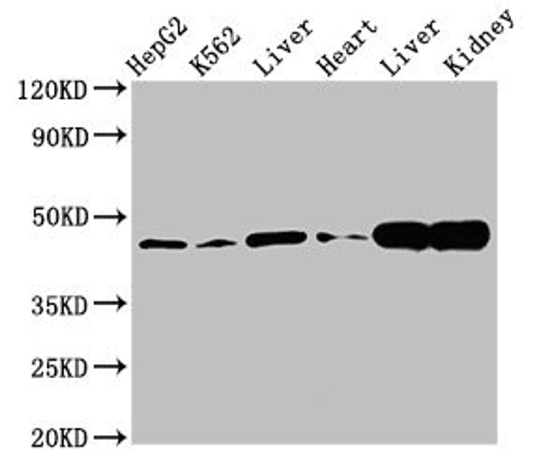 Western Blot. Positive WB detected in: HepG2 whole cell lysate, K562 whole cell lysate, Rat liver tissue, Mouse heart tissue, Mouse liver tissue Mouse kindey tissue. All lanes: ACAT1 antibody at 3µg/ml. Secondary. Goat polyclonal to rabbit IgG at 1/50000 dilution. Predicted band size: 46, 18 kDa. Observed band size: 46 kDa