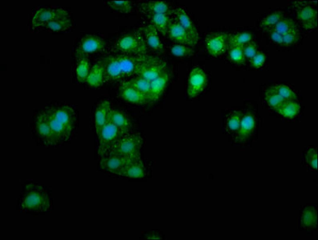 Immunofluorescence staining of HepG2 cells with CSB-PA07599A0Rb at 1:333, counter-stained with DAPI. The cells were fixed in 4% formaldehyde, permeabilized using 0.2% Triton X-100 and blocked in 10% normal Goat Serum. The cells were then incubated with the antibody overnight at 4&deg;C. The secondary antibody was Alexa Fluor 488-congugated AffiniPure Goat Anti-Rabbit IgG(H+L).