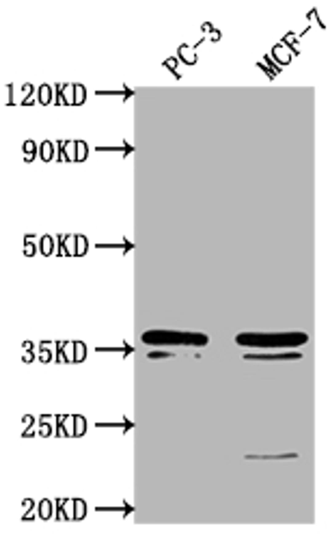 Western Blot. Positive WB detected in: PC-3 whole cell lysate, MCF-7 whole cell lysate. All lanes: OR6C1 antibody at 1:1000. Secondary. Goat polyclonal to rabbit IgG at 1/50000 dilution. Predicted band size: 36 kDa. Observed band size: 36 kDa. 