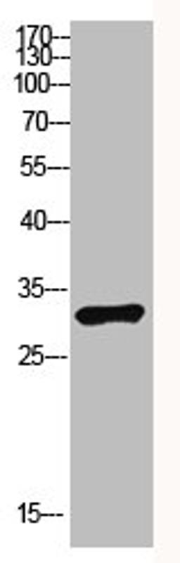 Western Blot analysis of NT28 cells using Antibody diluted at 1000. Secondary antibody  was diluted at 1:20000