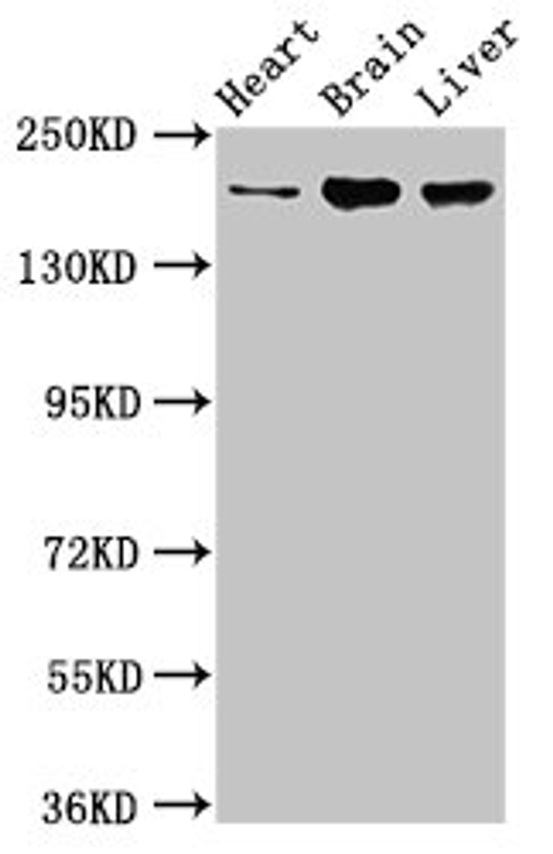 Western Blot. Positive WB detected in: Rat heart tissue, Mouse brain tissue, Mouse liver tissue. All lanes: ARFGEF2 antibody at 3.2ug/ml. Secondary. Goat polyclonal to rabbit IgG at 1/50000 dilution. Predicted band size: 203 kDa. Observed band size: 203 kDa.