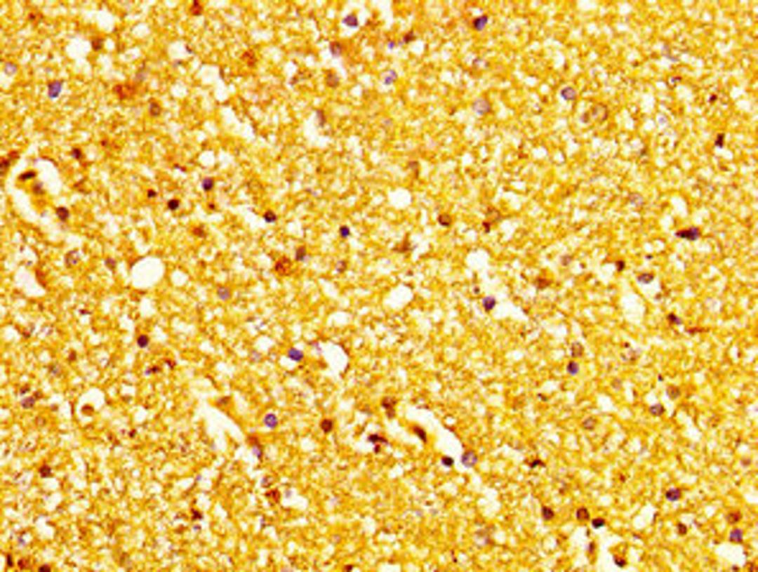 IHC image of CSB-PA013585LA01HU diluted at 1:200 and staining in paraffin-embedded human brain tissue performed on a Leica BondTM system. After dewaxing and hydration, antigen retrieval was mediated by high pressure in a citrate buffer (pH 6.0). Section was blocked with 10% normal goat serum 30min at RT. Then primary antibody (1% BSA) was incubated at 4&deg;C overnight. The primary is detected by a biotinylated secondary antibody and visualized using an HRP conjugated SP system.