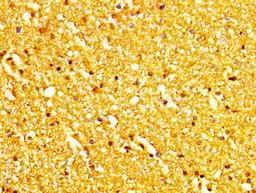 IHC image of CSB-PA013585LA01HU diluted at 1:200 and staining in paraffin-embedded human brain tissue performed on a Leica BondTM system. After dewaxing and hydration, antigen retrieval was mediated by high pressure in a citrate buffer (pH 6.0). Section was blocked with 10% normal goat serum 30min at RT. Then primary antibody (1% BSA) was incubated at 4&deg;C overnight. The primary is detected by a biotinylated secondary antibody and visualized using an HRP conjugated SP system.