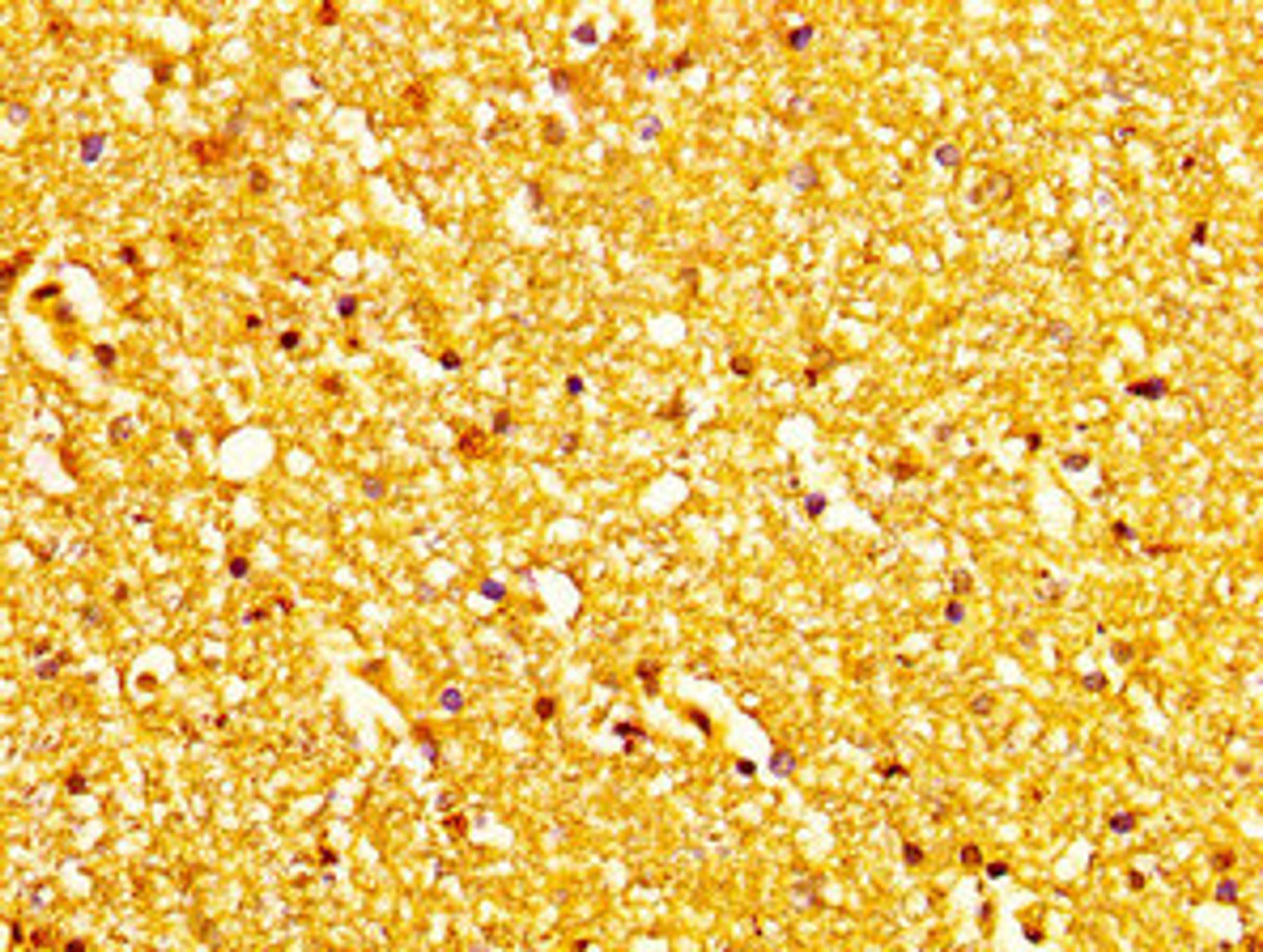 IHC image of CSB-PA013585LA01HU diluted at 1:200 and staining in paraffin-embedded human brain tissue performed on a Leica BondTM system. After dewaxing and hydration, antigen retrieval was mediated by high pressure in a citrate buffer (pH 6.0). Section was blocked with 10% normal goat serum 30min at RT. Then primary antibody (1% BSA) was incubated at 4&deg;C overnight. The primary is detected by a biotinylated secondary antibody and visualized using an HRP conjugated SP system.