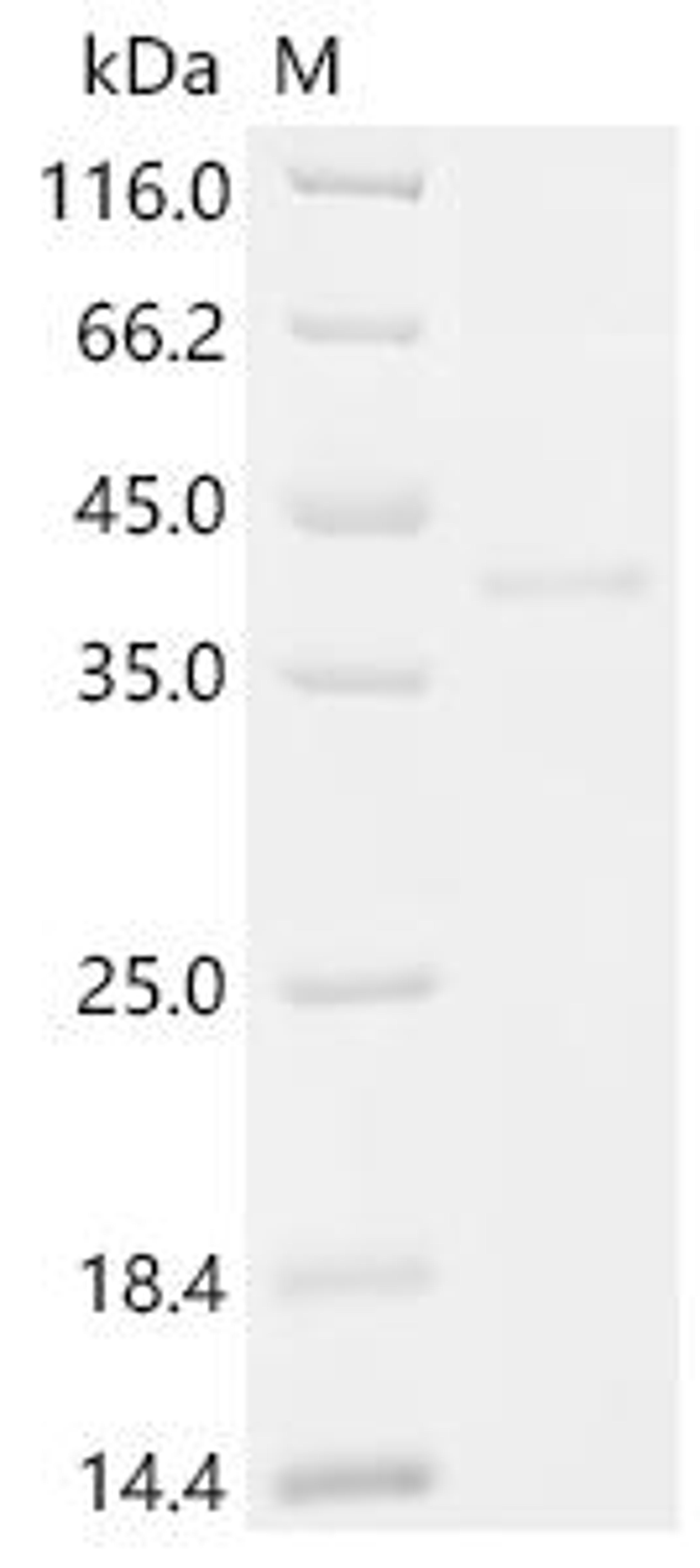 (Tris-Glycine gel) Discontinuous SDS-PAGE (reduced) with 5% enrichment gel and 15% separation gel.