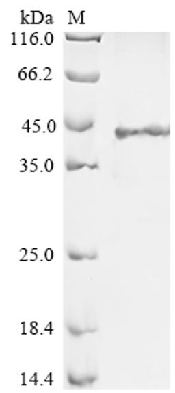 (Tris-Glycine gel) Discontinuous SDS-PAGE (reduced) with 5% enrichment gel and 15% separation gel.