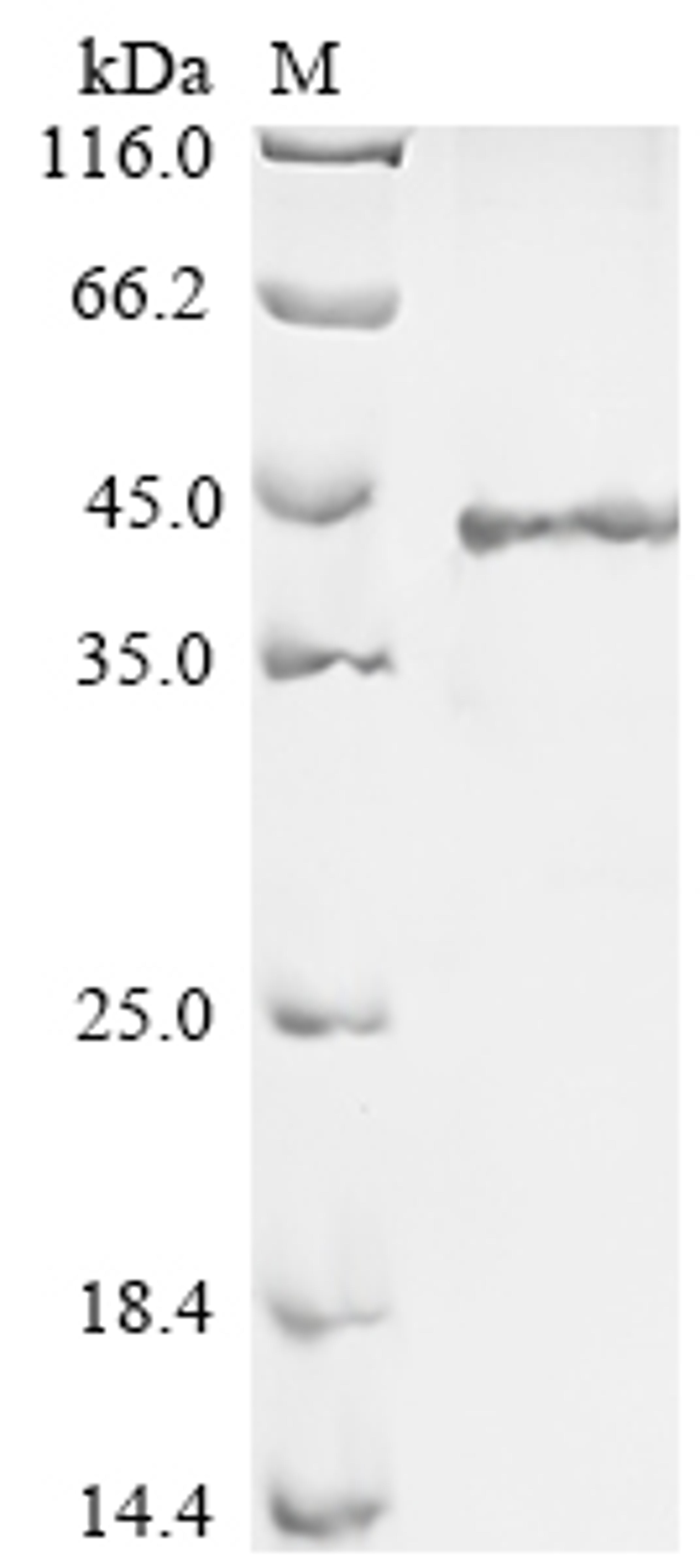 (Tris-Glycine gel) Discontinuous SDS-PAGE (reduced) with 5% enrichment gel and 15% separation gel.