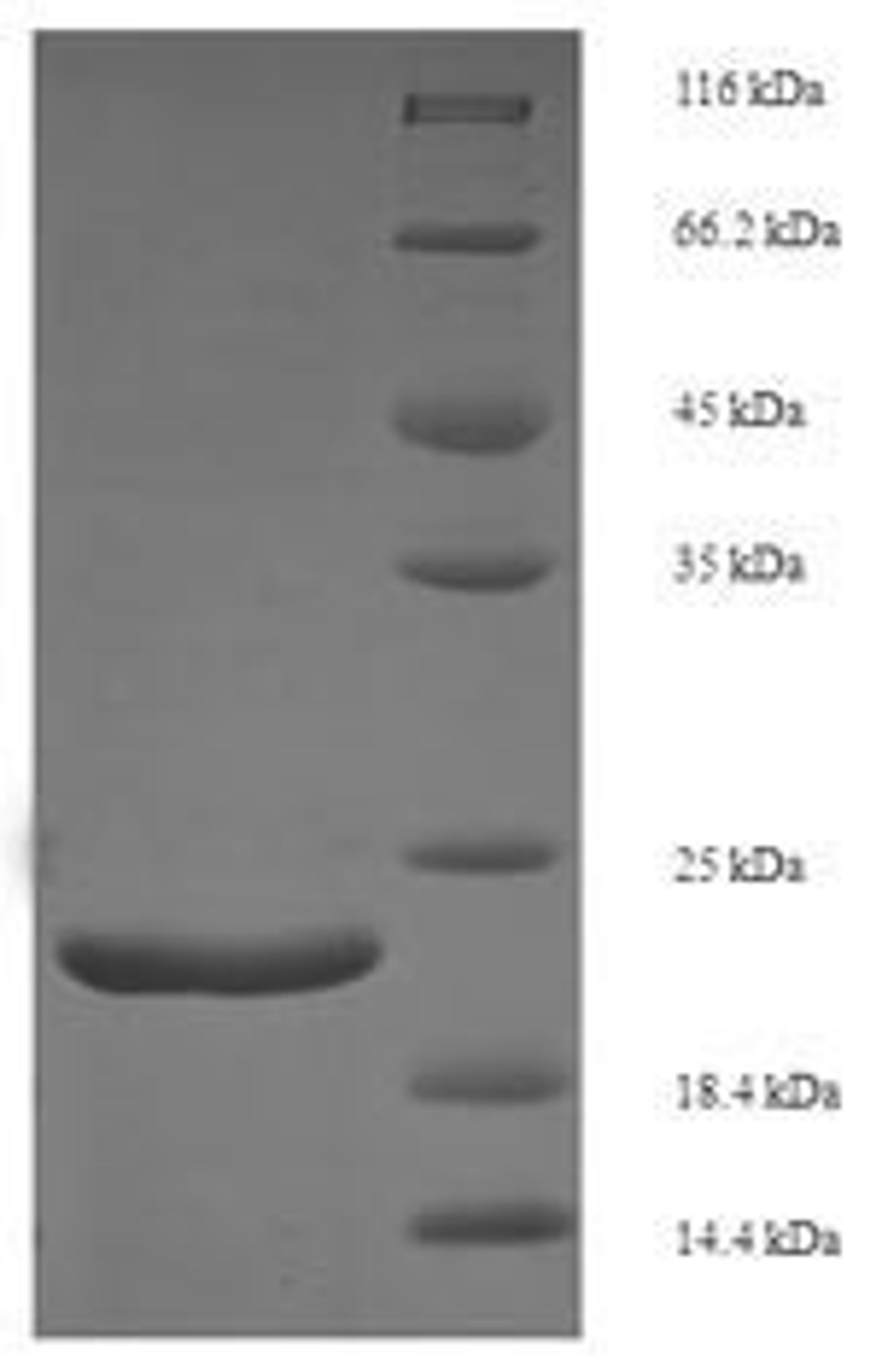 (Tris-Glycine gel) Discontinuous SDS-PAGE (reduced) with 5% enrichment gel and 15% separation gel.