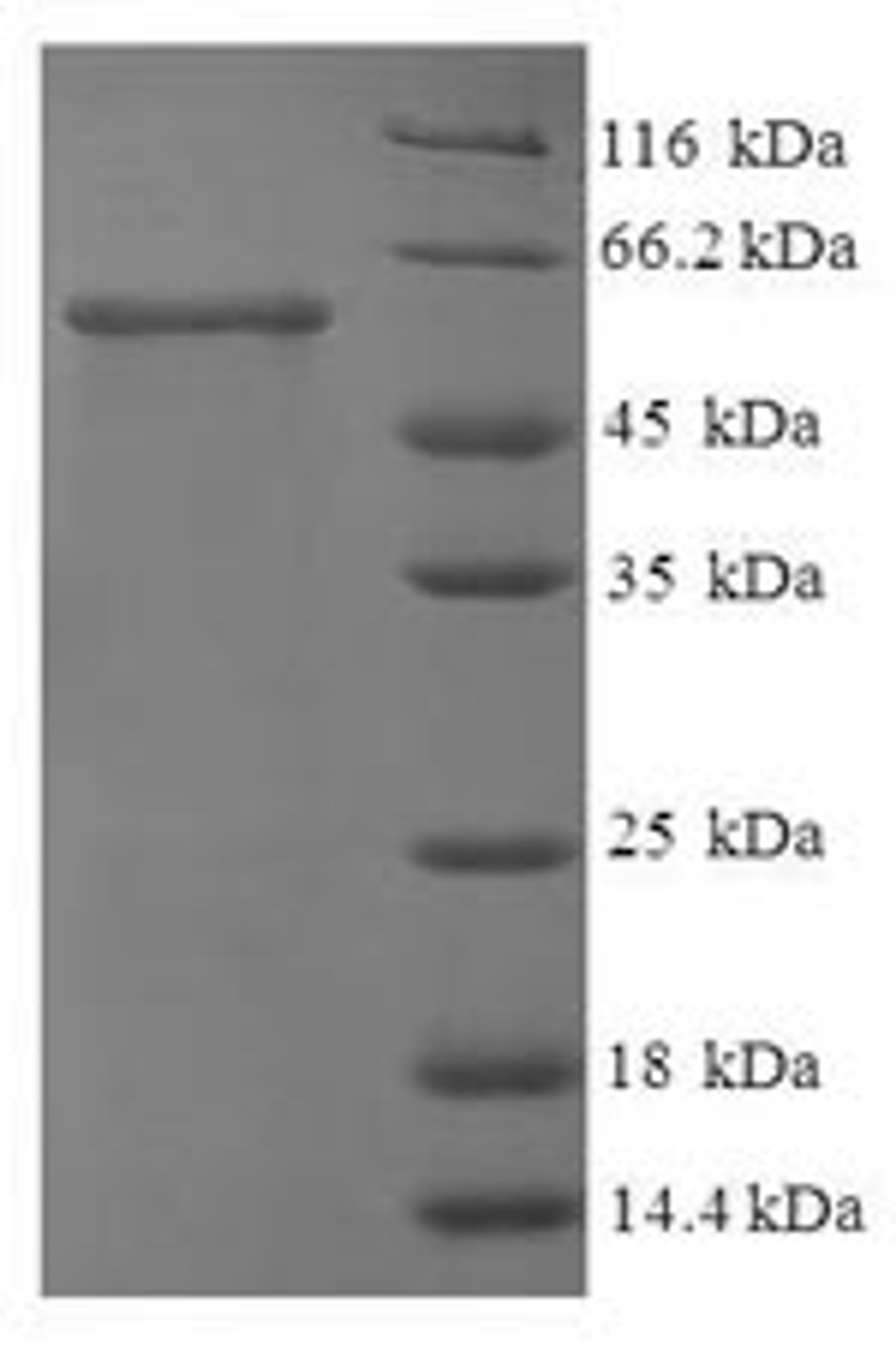 (Tris-Glycine gel) Discontinuous SDS-PAGE (reduced) with 5% enrichment gel and 15% separation gel.