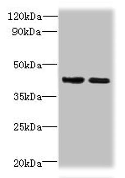 Western blot. All lanes: CHID1 antibody at 0.2ug/ml. Lane 1: Hela whole cell lysate. Lane 2: U251 whole cell lysate. Secondary. Goat polyclonal to rabbit IgG at 1/10000 dilution. Predicted band size: 45, 48, 42 kDa. Observed band size: 45 kDa. 