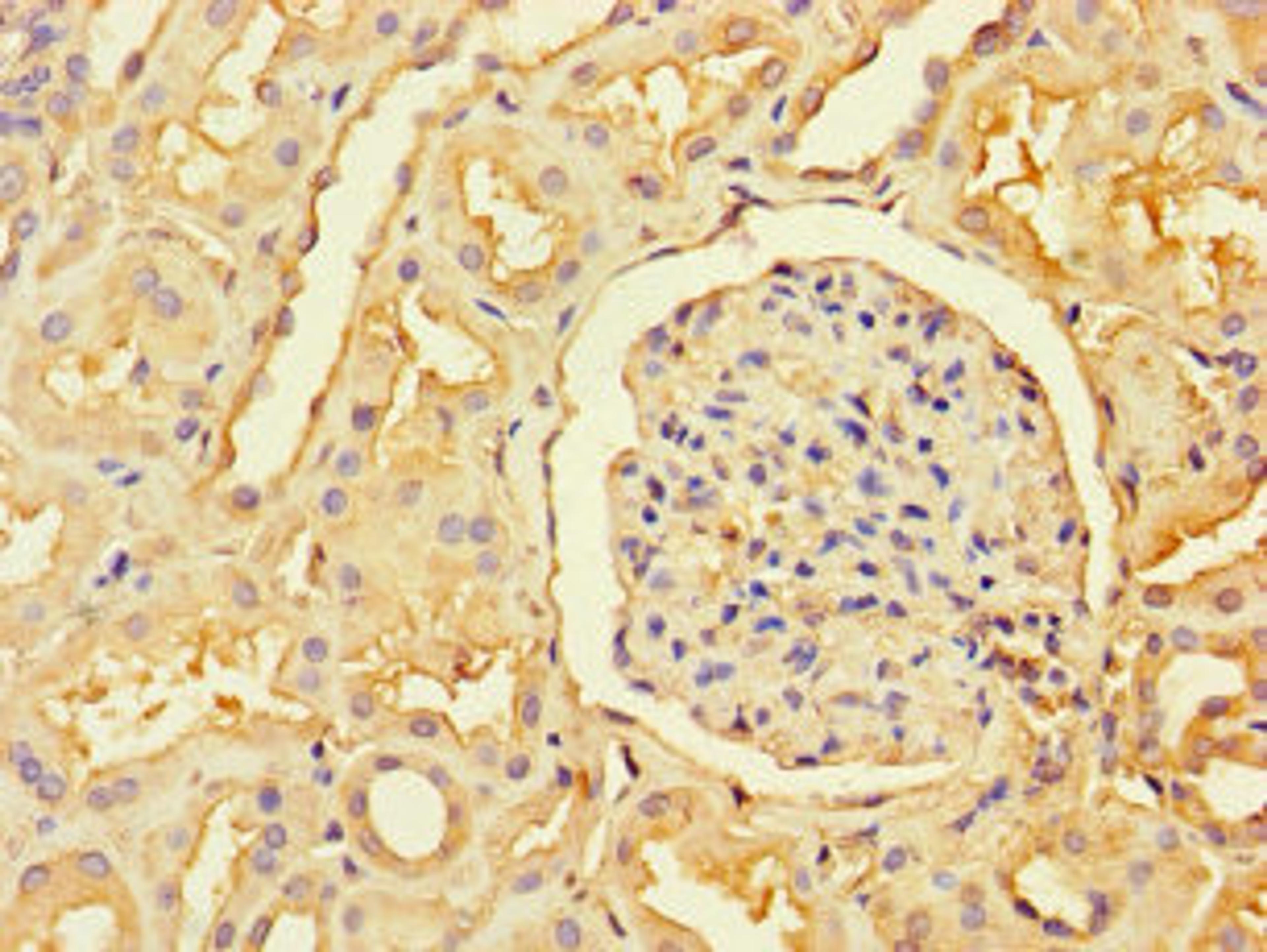 Immunohistochemistry of paraffin-embedded human kidney tissue using CSB-PA865137LA01HU at dilution of 1:100
