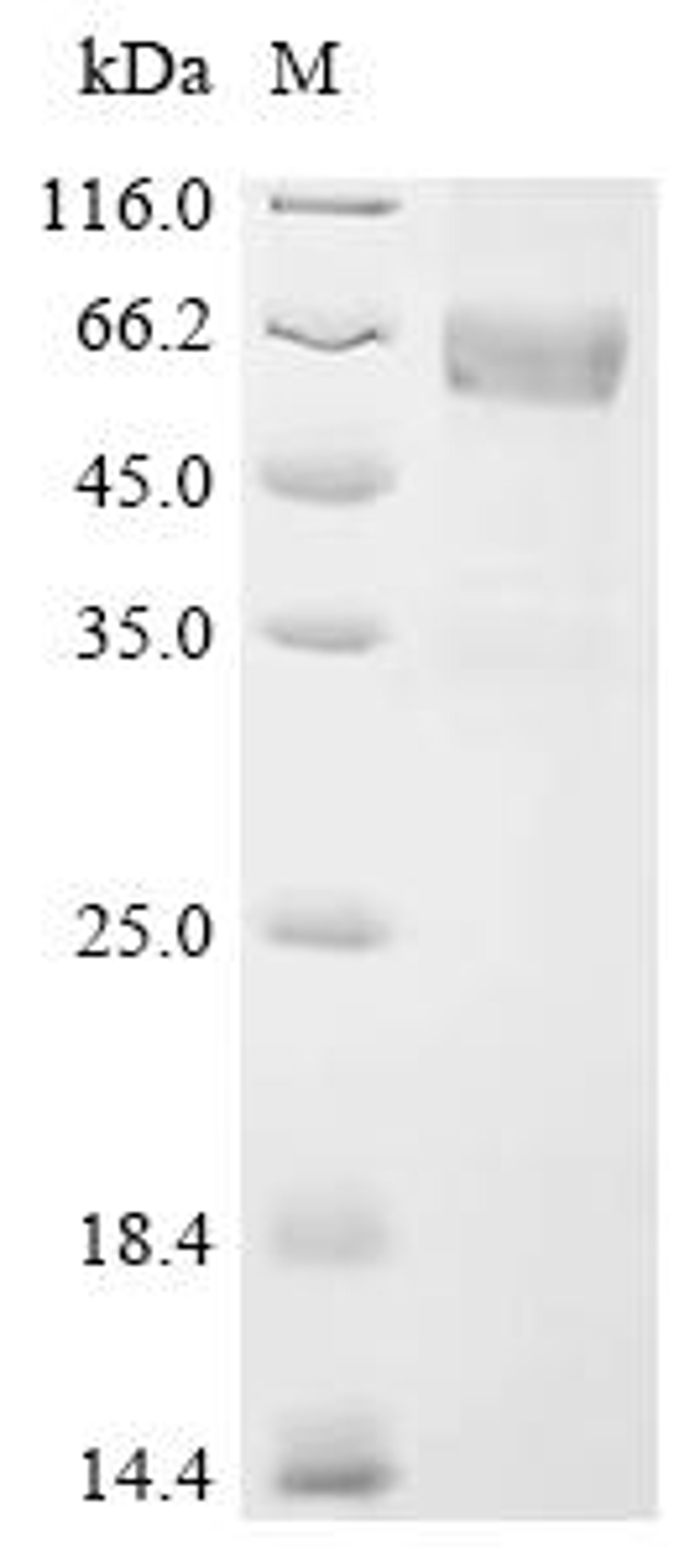 (Tris-Glycine gel) Discontinuous SDS-PAGE (reduced) with 5% enrichment gel and 15% separation gel.