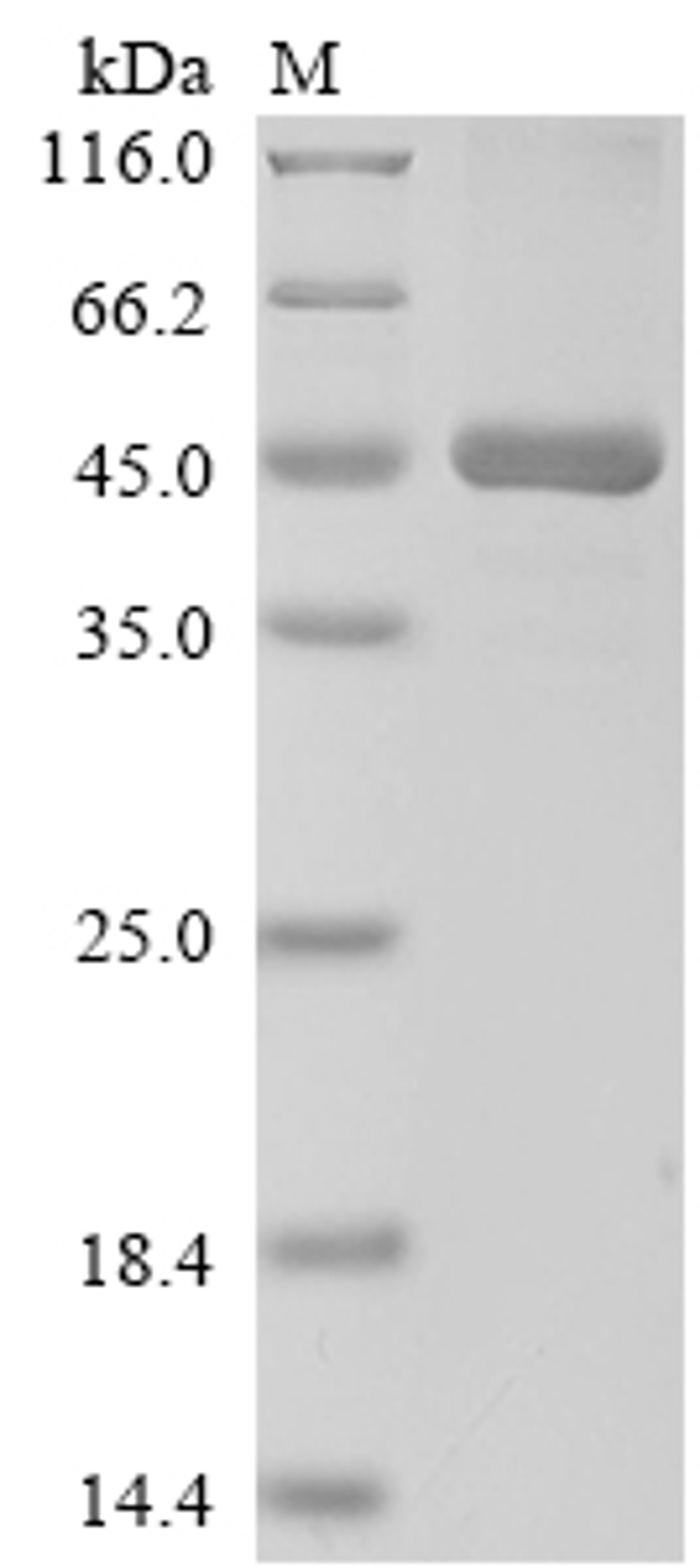 (Tris-Glycine gel) Discontinuous SDS-PAGE (reduced) with 5% enrichment gel and 15% separation gel.