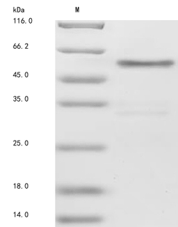 (Tris-Glycine gel) Discontinuous SDS-PAGE (reduced) with 5% enrichment gel and 15% separation gel.