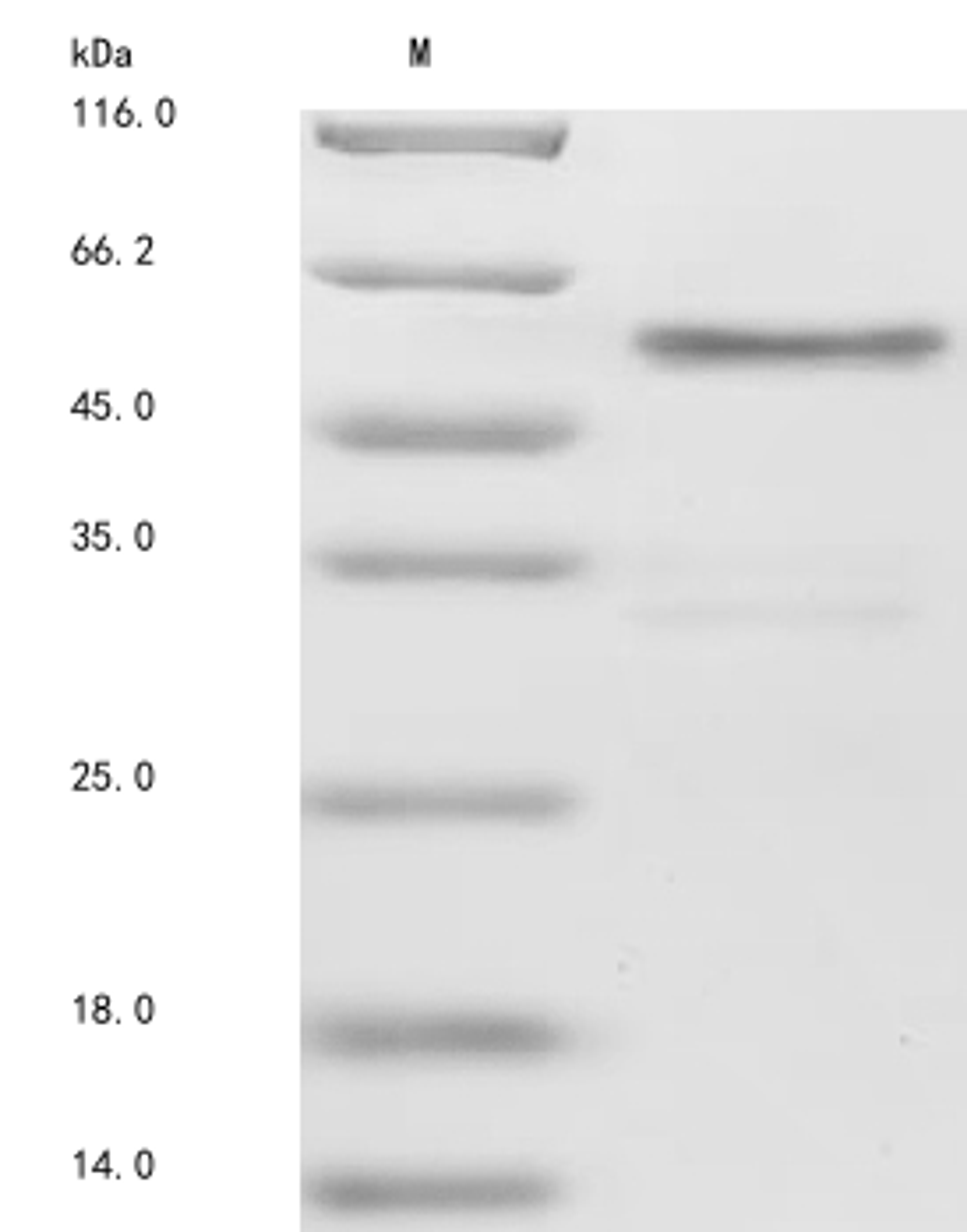 (Tris-Glycine gel) Discontinuous SDS-PAGE (reduced) with 5% enrichment gel and 15% separation gel.