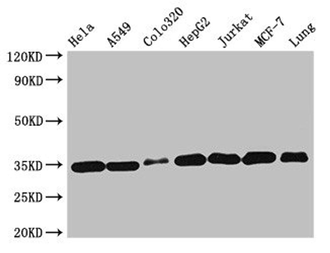Western Blot. Positive WB detected in: Hela whole cell lysate, A549 whole cell lysate, Colo320 whole cell lysate, HepG2 whole cell lysate, Jurkat whole cell lysate, MCF-7 whole cell lysate, Mouse lung tissue. All lanes: EMD antibody at 2µg/ml. Secondary. Goat polyclonal to rabbit IgG at 1/50000 dilution. Predicted band size: 29 kDa. Observed band size: 35 kDa