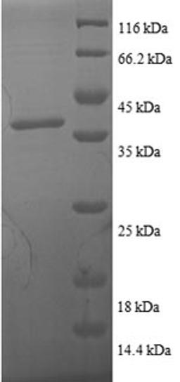 (Tris-Glycine gel) Discontinuous SDS-PAGE (reduced) with 5% enrichment gel and 15% separation gel.