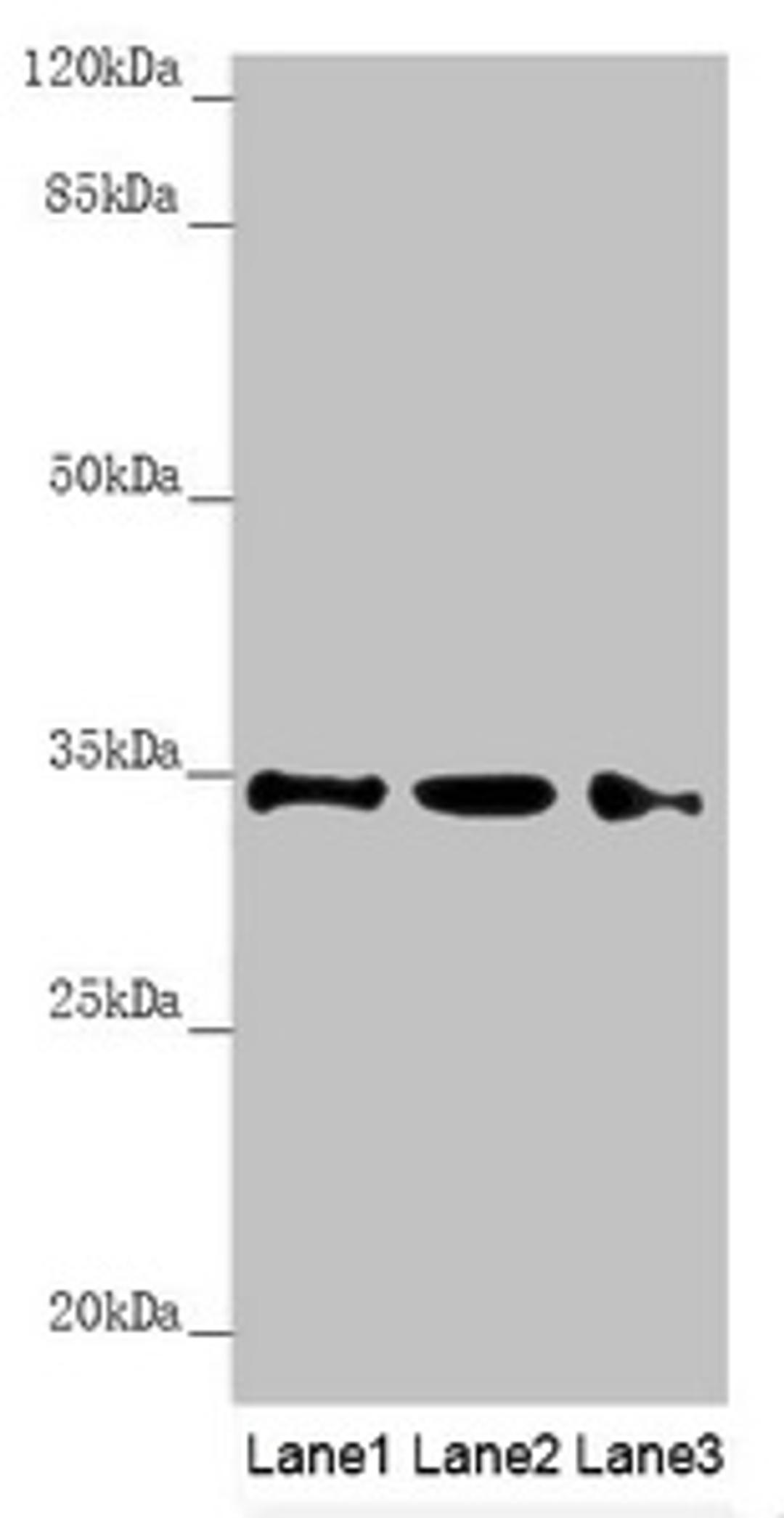 Western blot. All lanes: HADH antibody at 1.21 ug/ml. Lane 1: Mouse heart tissue. Lane 2: Mouse liver tissue. Lane 3: Mouse kidney tissue. Secondary. Goat polyclonal to rabbit IgG at 1/10000 dilution. Predicted band size: 35, 43, 37 kDa. Observed band size: 35 kDa. 