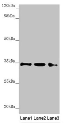 Western blot. All lanes: HADH antibody at 1.21 ug/ml. Lane 1: Mouse heart tissue. Lane 2: Mouse liver tissue. Lane 3: Mouse kidney tissue. Secondary. Goat polyclonal to rabbit IgG at 1/10000 dilution. Predicted band size: 35, 43, 37 kDa. Observed band size: 35 kDa. 