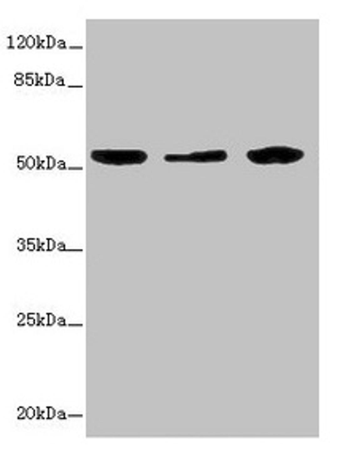Western blot. All lanes: KYNU antibody at 3.26ug/ml. Lane 1: A549 whole cell lysate. Lane 2: HepG2 whole cell lysate. Lane 3: THP-1 whole cell lysate. Secondary. Goat polyclonal to rabbit IgG at 1/10000 dilution. Predicted band size: 53, 35 kDa. Observed band size: 53 kDa. 