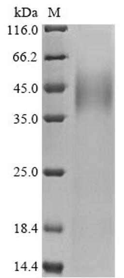 (Tris-Glycine gel) Discontinuous SDS-PAGE (reduced) with 5% enrichment gel and 15% separation gel.