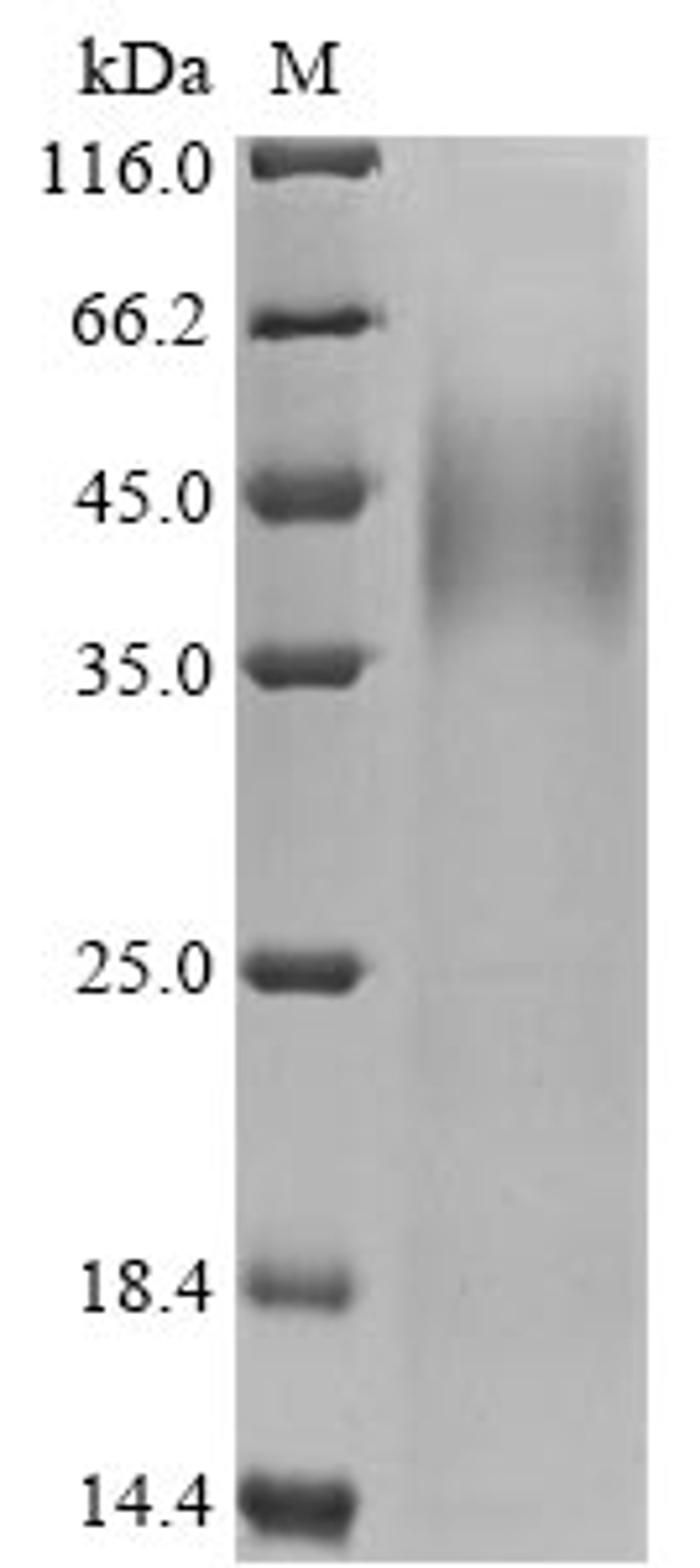 (Tris-Glycine gel) Discontinuous SDS-PAGE (reduced) with 5% enrichment gel and 15% separation gel.