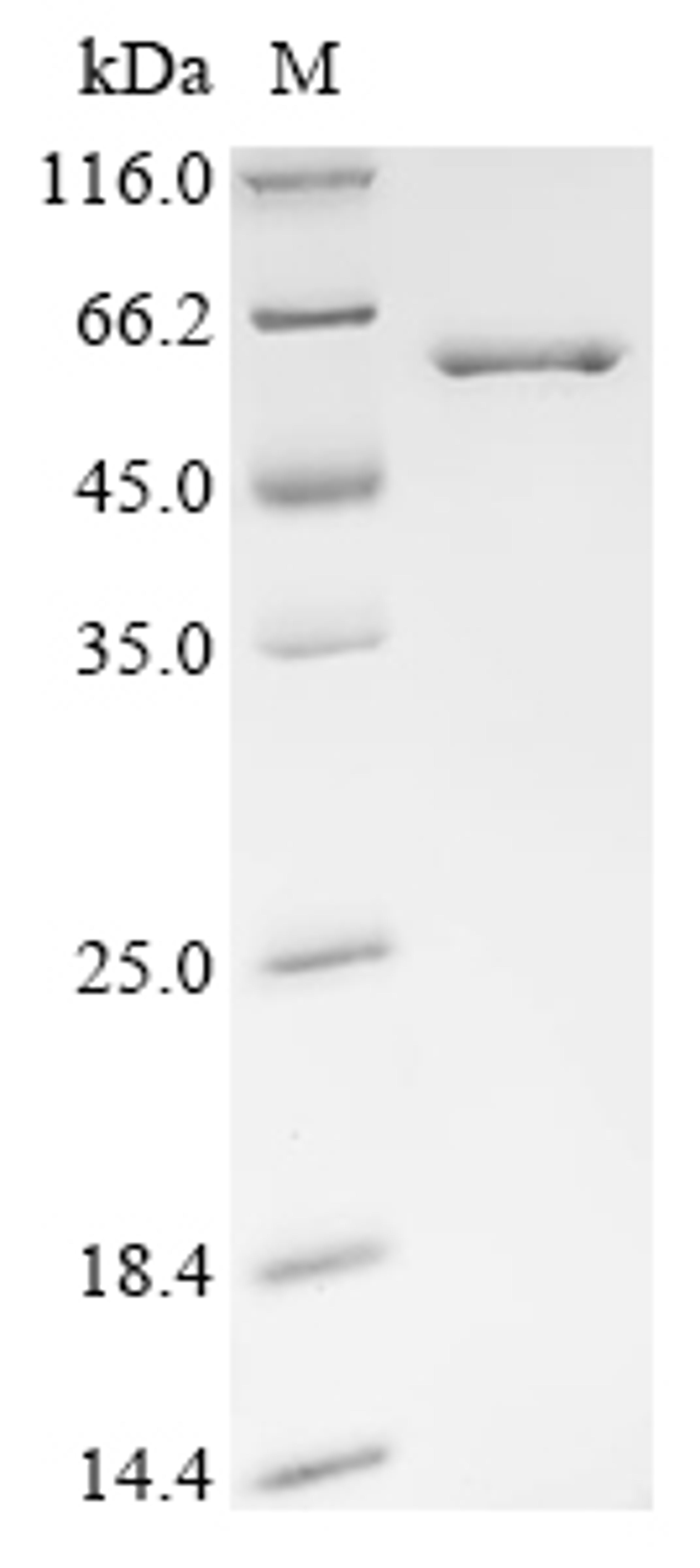 (Tris-Glycine gel) Discontinuous SDS-PAGE (reduced) with 5% enrichment gel and 15% separation gel.
