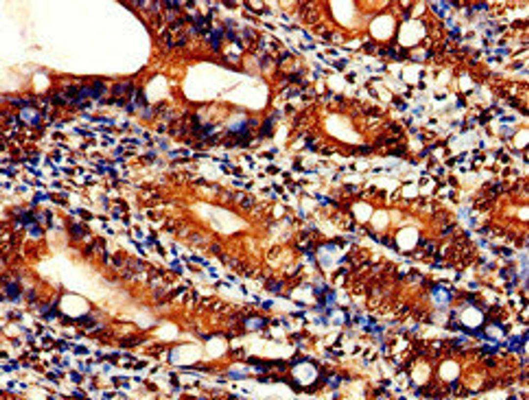 Immunohistochemistry of paraffin-embedded human small intestine tissue using CSB-PA801231LA01HU at dilution of 1:100