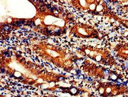 Immunohistochemistry of paraffin-embedded human small intestine tissue using CSB-PA801231LA01HU at dilution of 1:100
