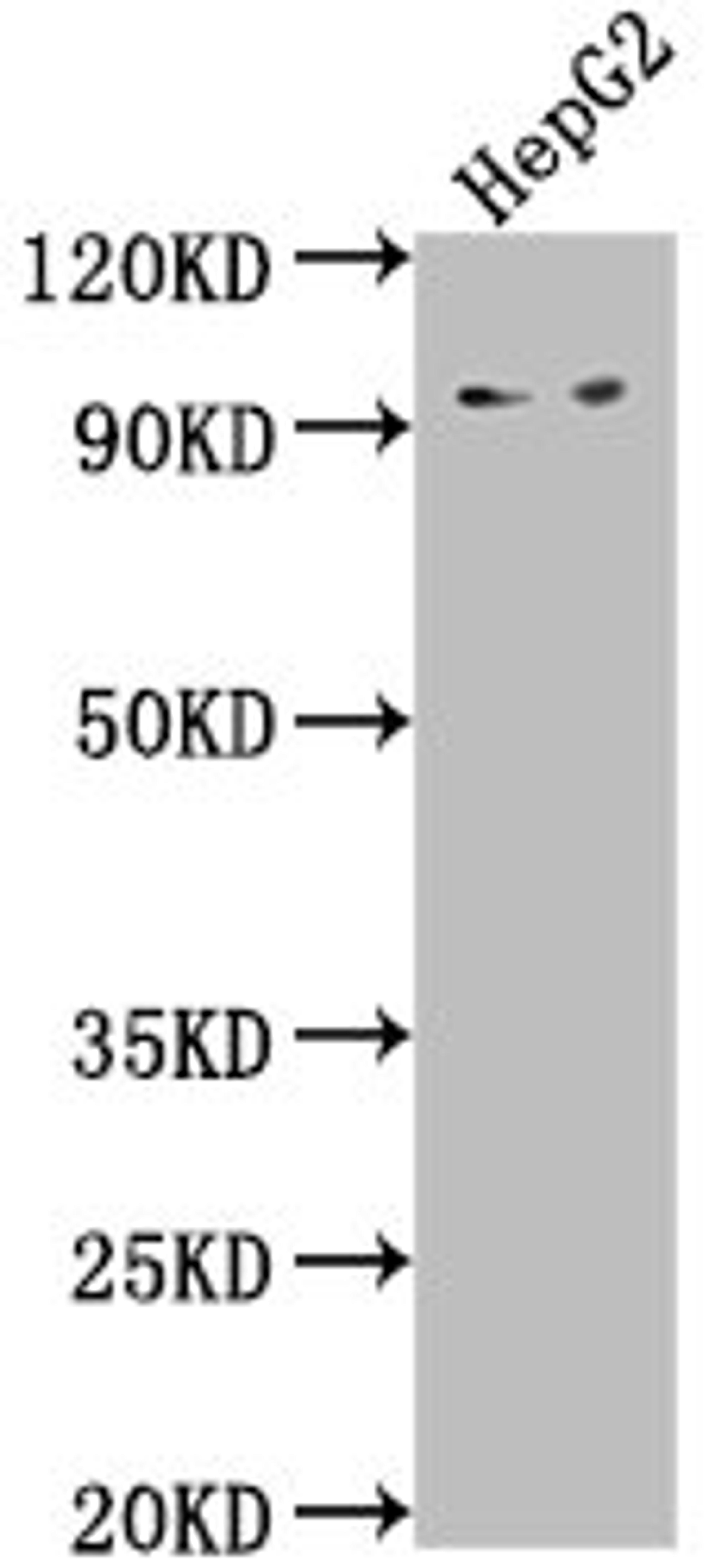 Western Blot. Positive WB detected in: HepG2 whole cell lysate. All lanes: AVIL antibody at 1:2000. Secondary. Goat polyclonal to rabbit IgG at 1/50000 dilution. Predicted band size: 93, 92 kDa. Observed band size: 93 kDa. 