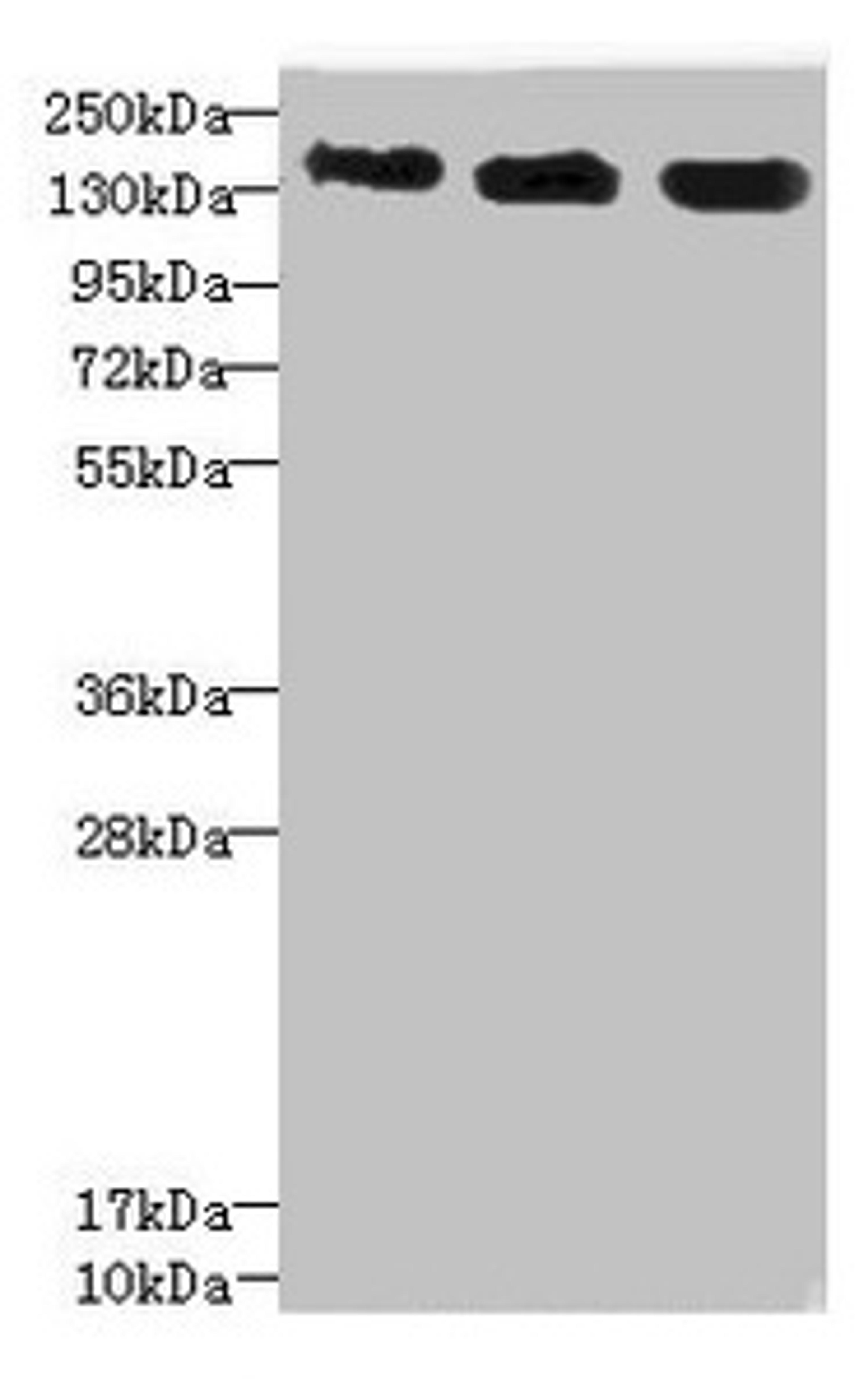Western blot. All lanes: ANKS1B antibody at 5.28µg/ml. Lane 1: 293T whole cell lysate. Lane 2: HepG2 whole cell lysate. Lane 3: Hela whole cell lysate. Secondary. Goat polyclonal to rabbit IgG at 1/10000 dilution. Predicted band size: 139, 49, 58, 53, 52, 86, 48, 41, 29, 45 kDa. Observed band size: 139 kDa