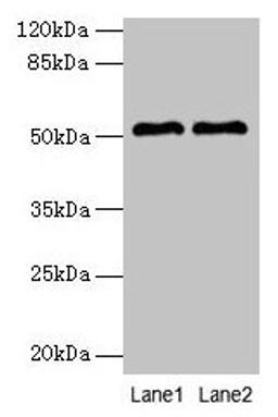 Western blot. All lanes: SLC30A6 antibody at 6µg/ml. Lane 1: A549 whole cell lysate. Lane 2: U251 whole cell lysate. Secondary. Goat polyclonal to rabbit IgG at 1/10000 dilution. Predicted band size: 52, 56, 48, 49 kDa. Observed band size: 52 kDa