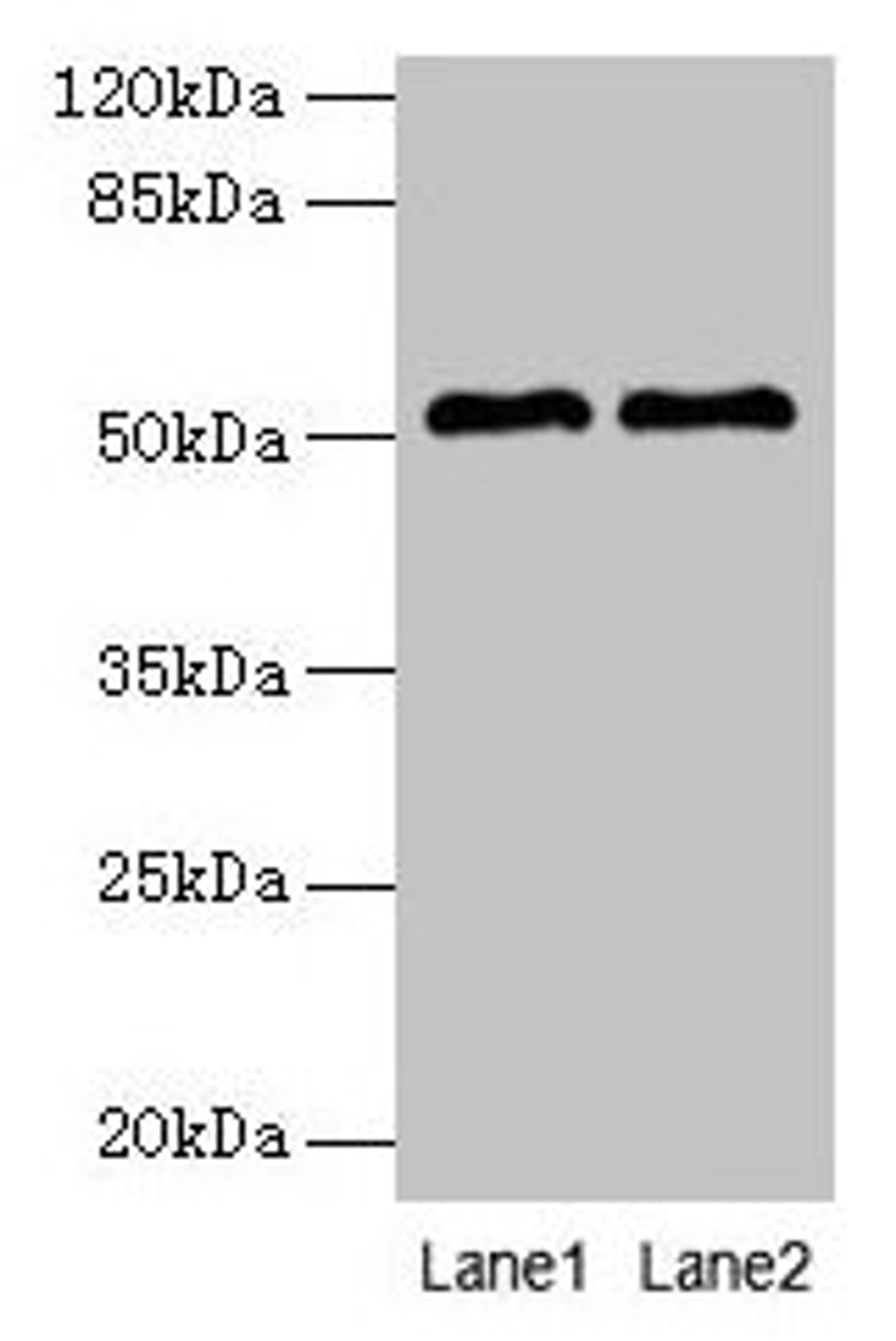 Western blot. All lanes: SLC30A6 antibody at 6µg/ml. Lane 1: A549 whole cell lysate. Lane 2: U251 whole cell lysate. Secondary. Goat polyclonal to rabbit IgG at 1/10000 dilution. Predicted band size: 52, 56, 48, 49 kDa. Observed band size: 52 kDa