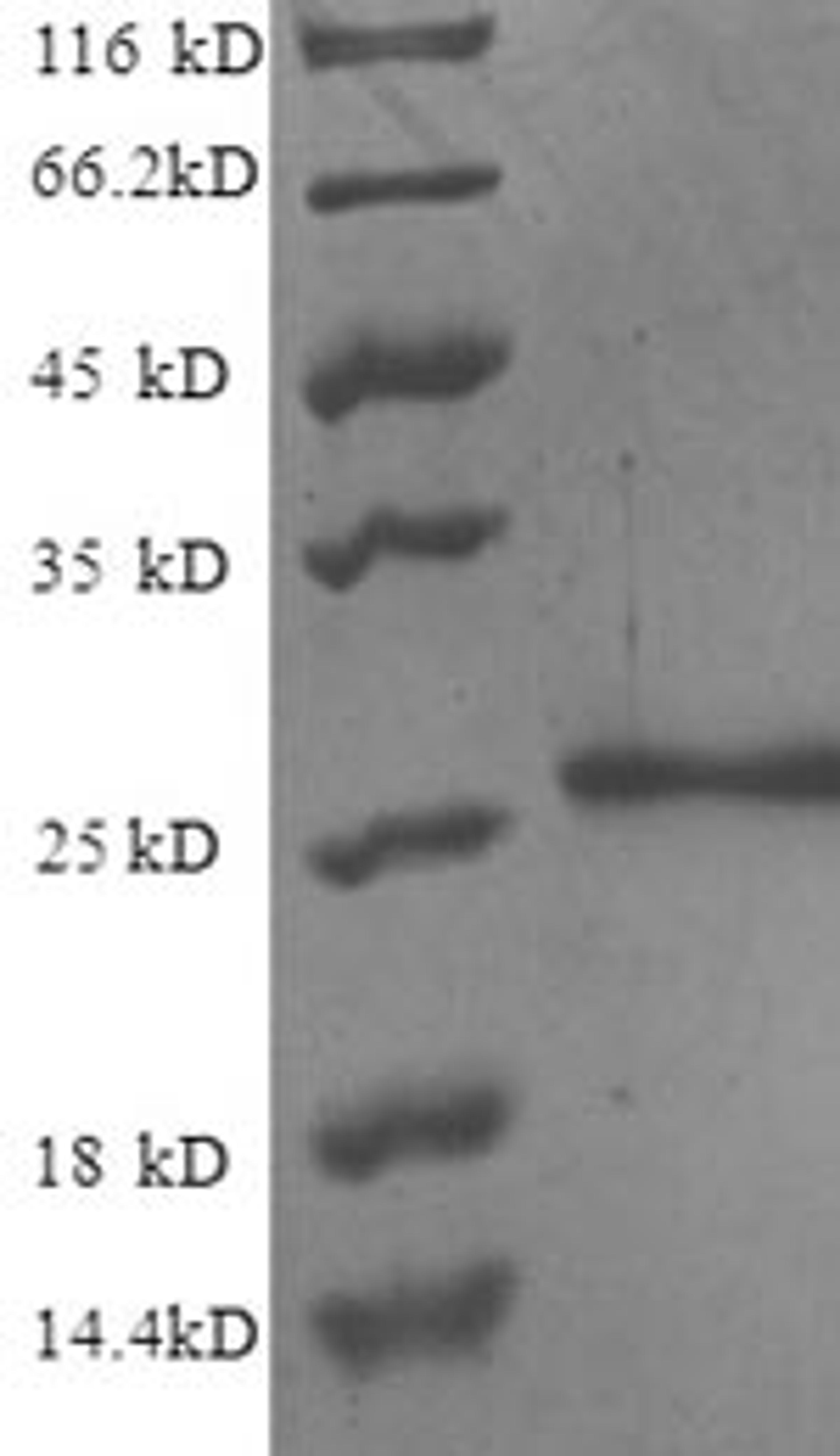(Tris-Glycine gel) Discontinuous SDS-PAGE (reduced) with 5% enrichment gel and 15% separation gel.