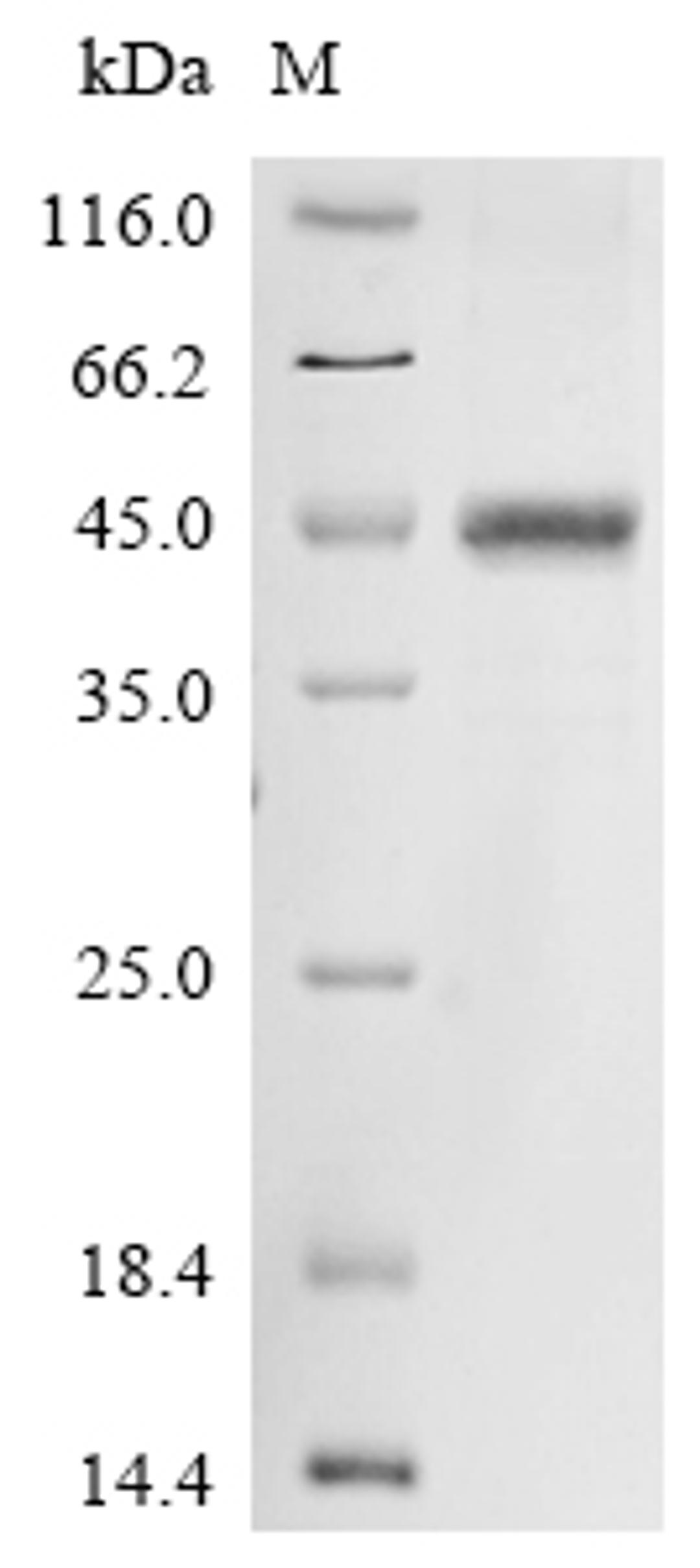 (Tris-Glycine gel) Discontinuous SDS-PAGE (reduced) with 5% enrichment gel and 15% separation gel.