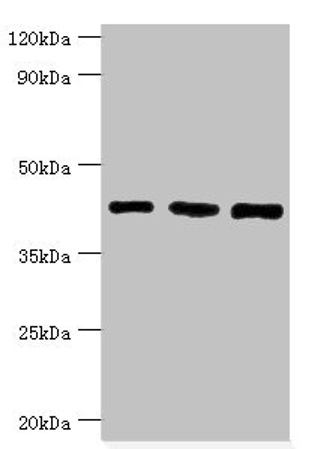 Western blot. All lanes: SWI/SNF-related matrix-associated actin-dependent regulator of chromatin subfamily B member 1 antibody at 8ug/ml. Lane 1: Hela whole cell lysate. Lane 2: 293T whole cell lysate. Lane 3: Mouse stomach tissue. Secondary. Goat polyclonal to rabbit IgG at 1/10000 dilution. Predicted band size: 45, 44 kDa. Observed band size: 45 kDa. 