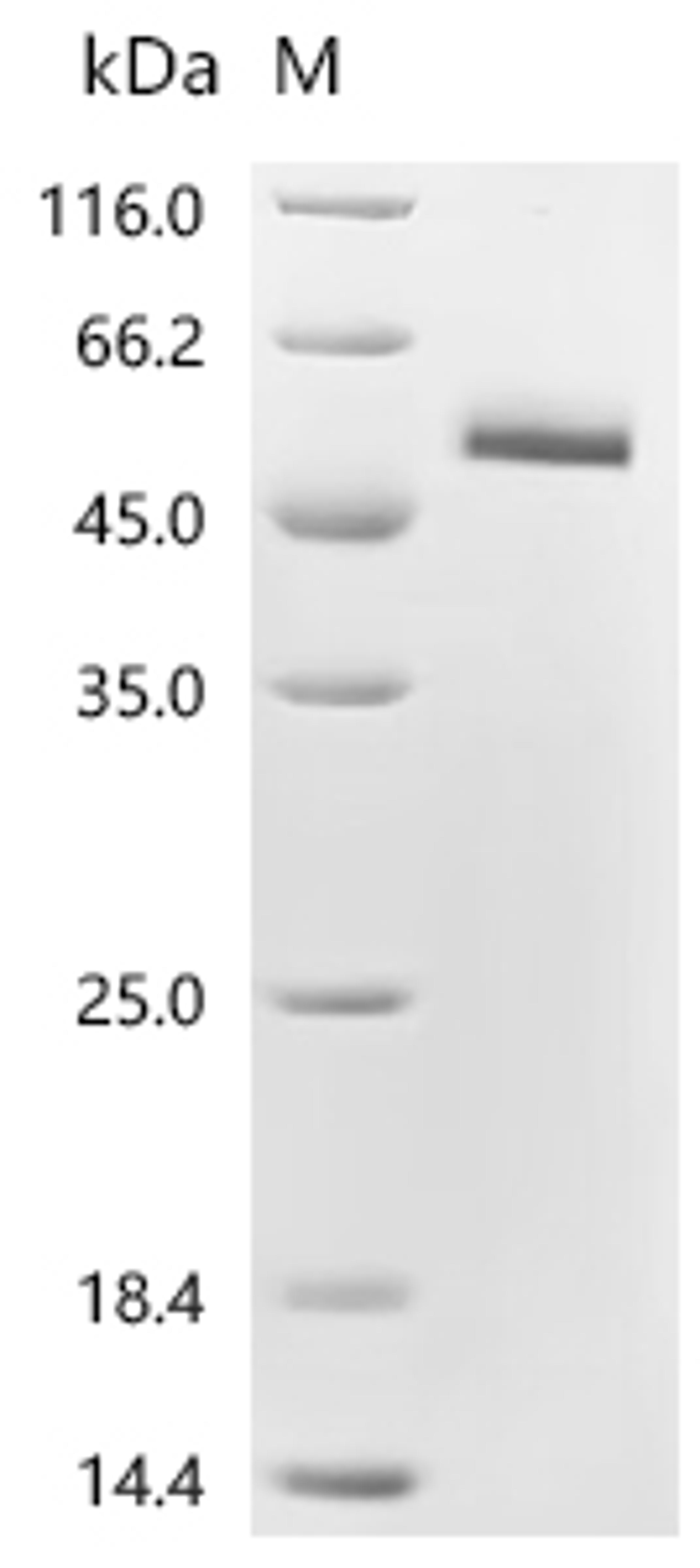 (Tris-Glycine gel) Discontinuous SDS-PAGE (reduced) with 5% enrichment gel and 15% separation gel.