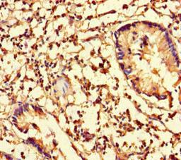 Immunohistochemistry of paraffin-embedded human appendix tissue using CSB-PA04709A0Rb at dilution of 1:100