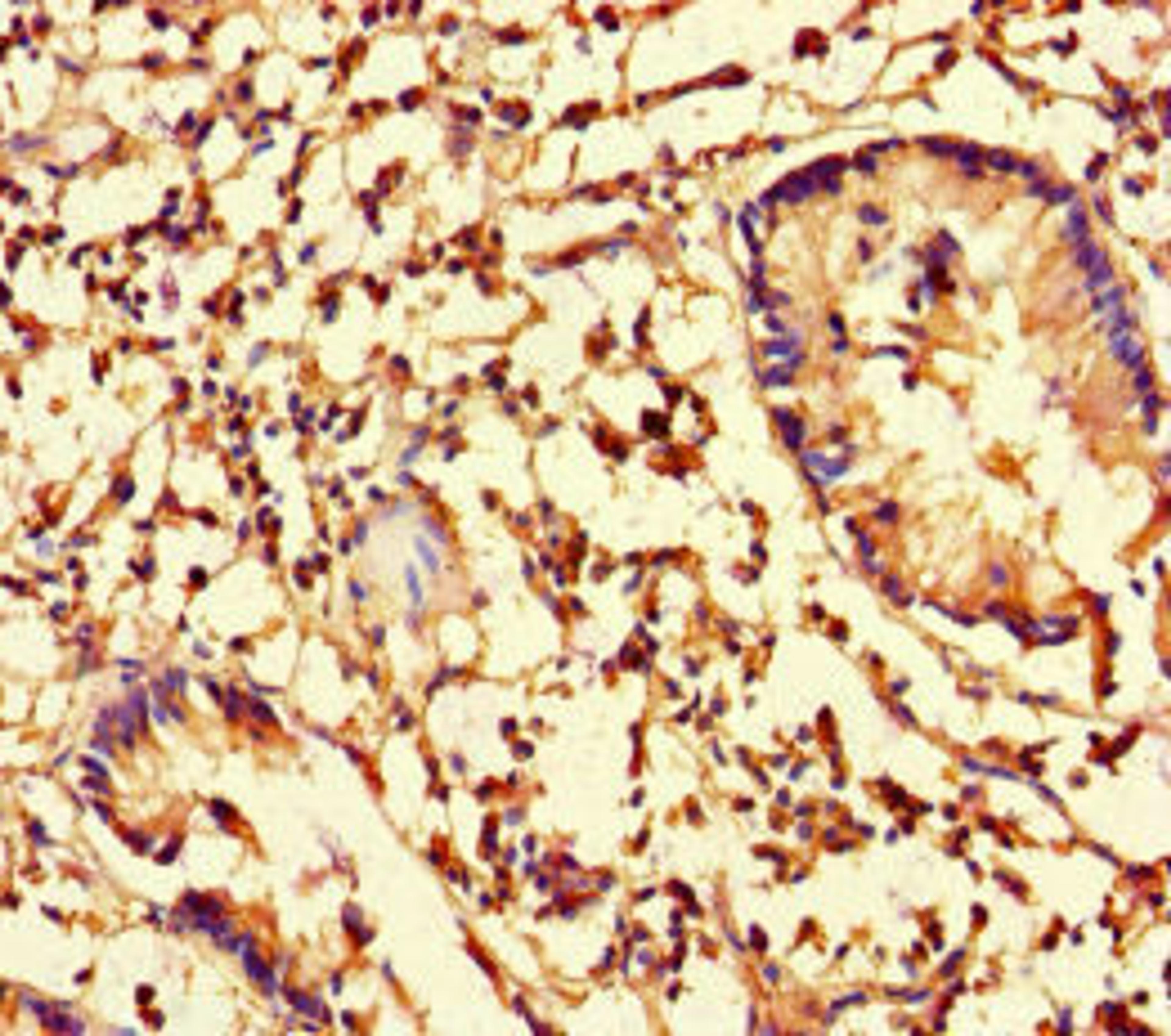 Immunohistochemistry of paraffin-embedded human appendix tissue using CSB-PA04709A0Rb at dilution of 1:100