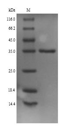 (Tris-Glycine gel) Discontinuous SDS-PAGE (reduced) with 5% enrichment gel and 15% separation gel.