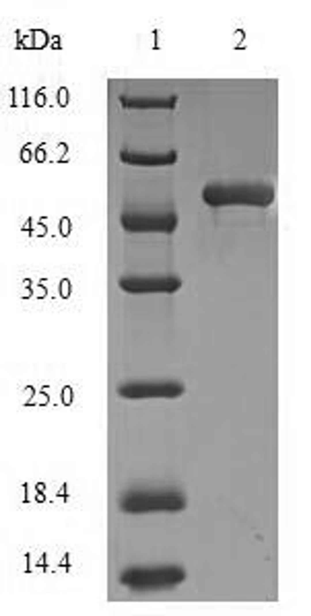 (Tris-Glycine gel) Discontinuous SDS-PAGE (reduced) with 5% enrichment gel and 15% separation gel.