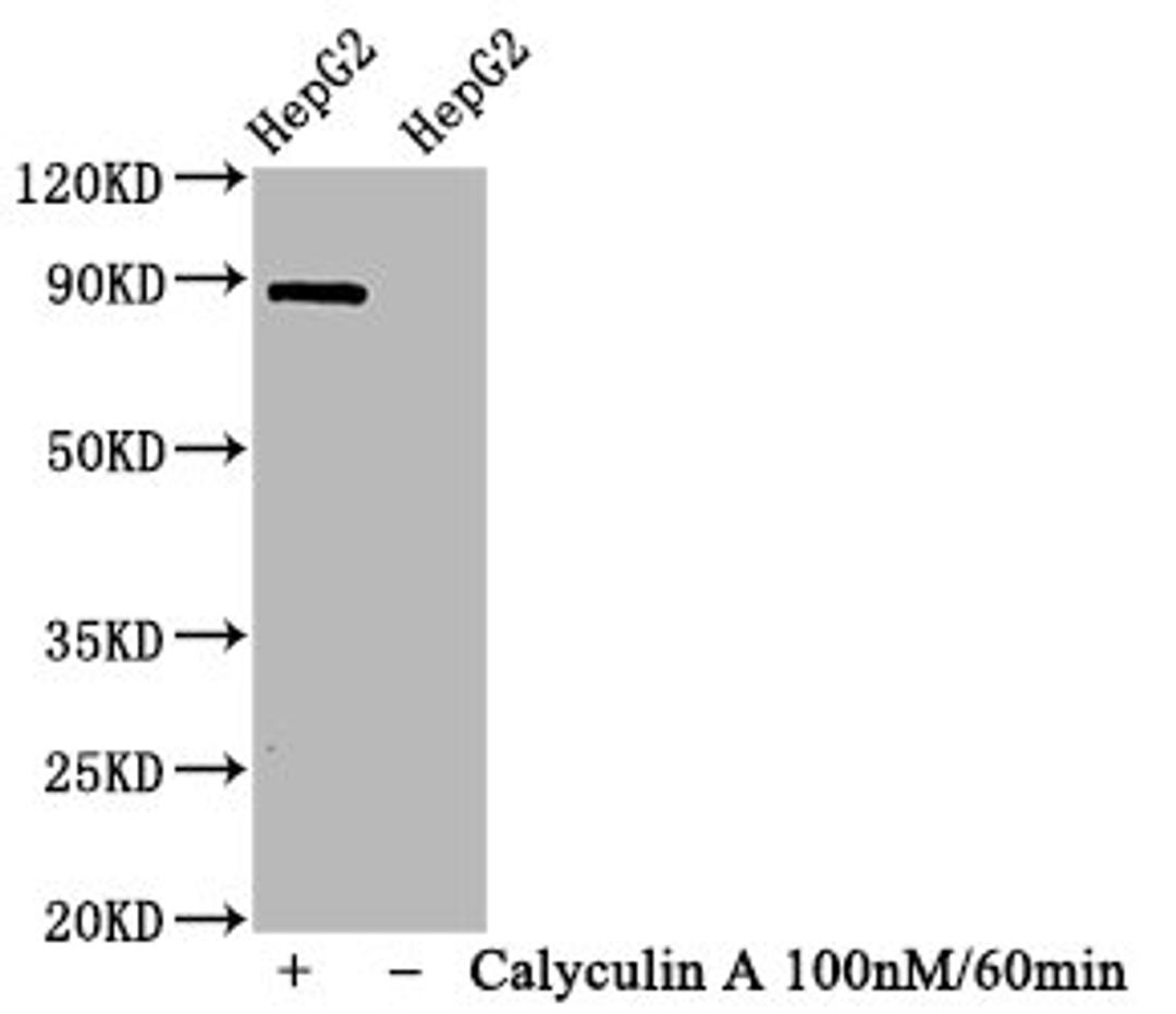 Western Blot. Positive WB detected in HepG2 whole cell lysate(treated with Calyculin A or not). All lanes Phospho-STAT1 antibody at 1.065μg/ml. Secondary. Goat polyclonal to rabbit IgG at 1/50000 dilution. Predicted band size: 87 KDa. Observed band size: 87 KDa. 