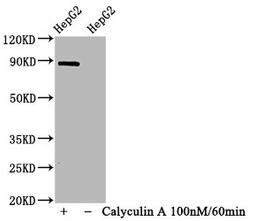 Western Blot. Positive WB detected in HepG2 whole cell lysate(treated with Calyculin A or not). All lanes Phospho-STAT1 antibody at 1.065μg/ml. Secondary. Goat polyclonal to rabbit IgG at 1/50000 dilution. Predicted band size: 87 KDa. Observed band size: 87 KDa. 