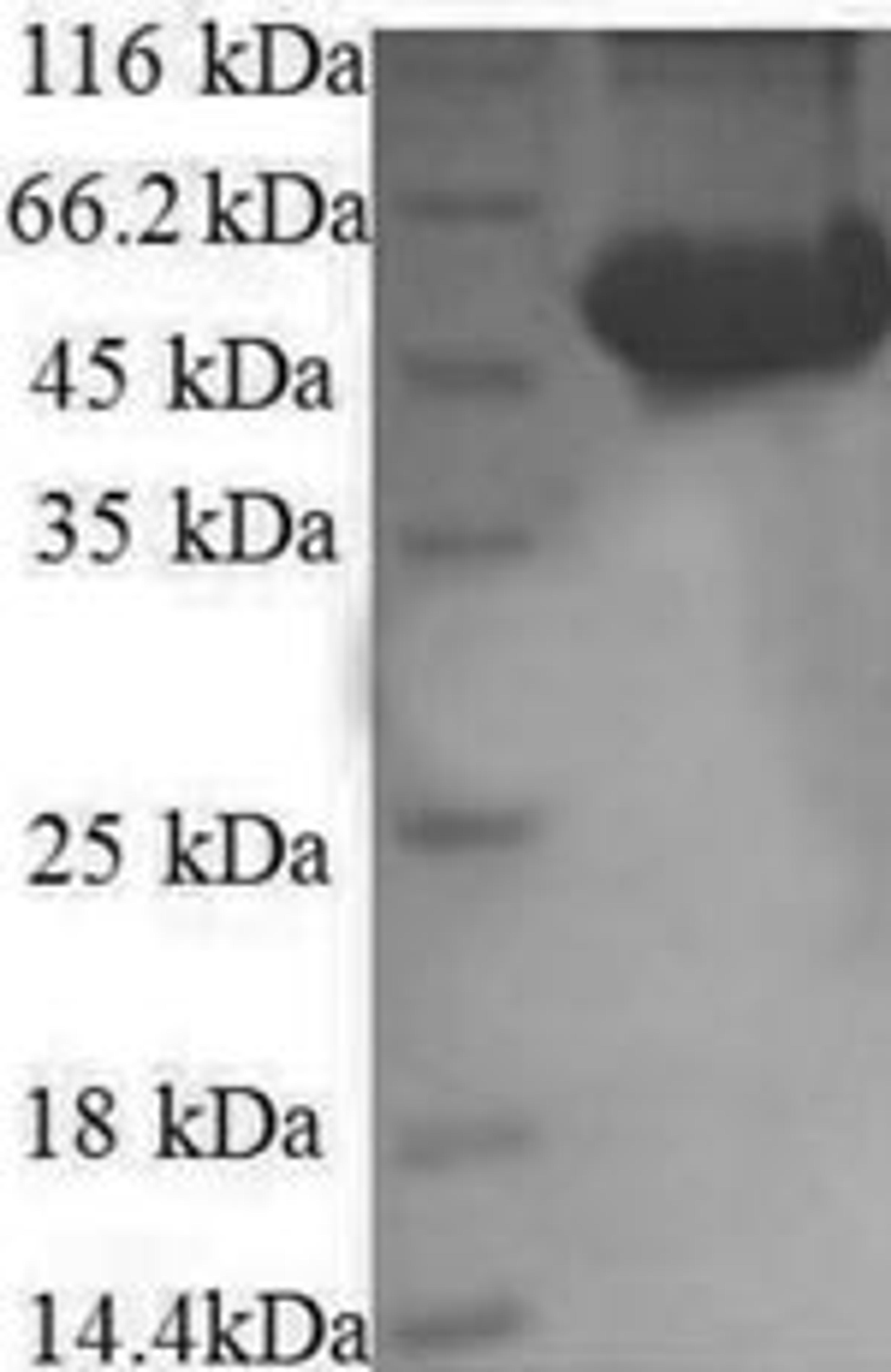 (Tris-Glycine gel) Discontinuous SDS-PAGE (reduced) with 5% enrichment gel and 15% separation gel.