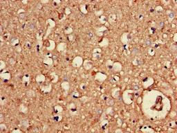 Immunohistochemistry of paraffin-embedded human brain tissue using CSB-PA016070LA01HU at dilution of 1:100